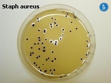 S aureus on Baird Parker Agar